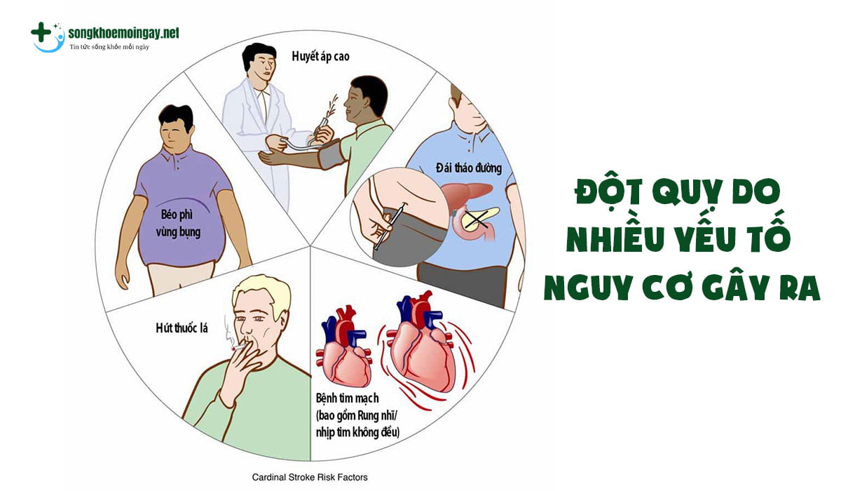 Có nhiều nguyên nhân dẫn đến tình trạng đột quỵ ở Việt Nam tăng cao